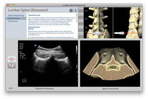 screen capture of Virtual Spine Regional Anesthesia module